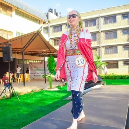 A model with albinism walking the Black Albinism runway in a bold printed coat.