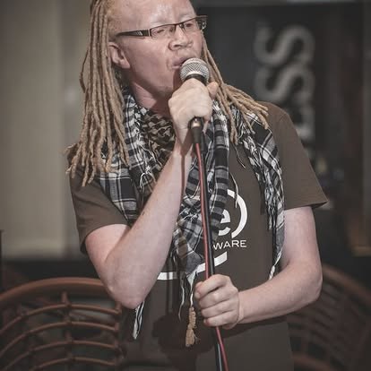 A singer with albinism performing into a microphone.