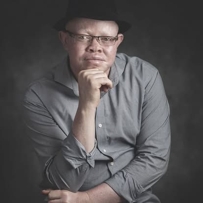A studio portrait of a man with albinism in a hat.