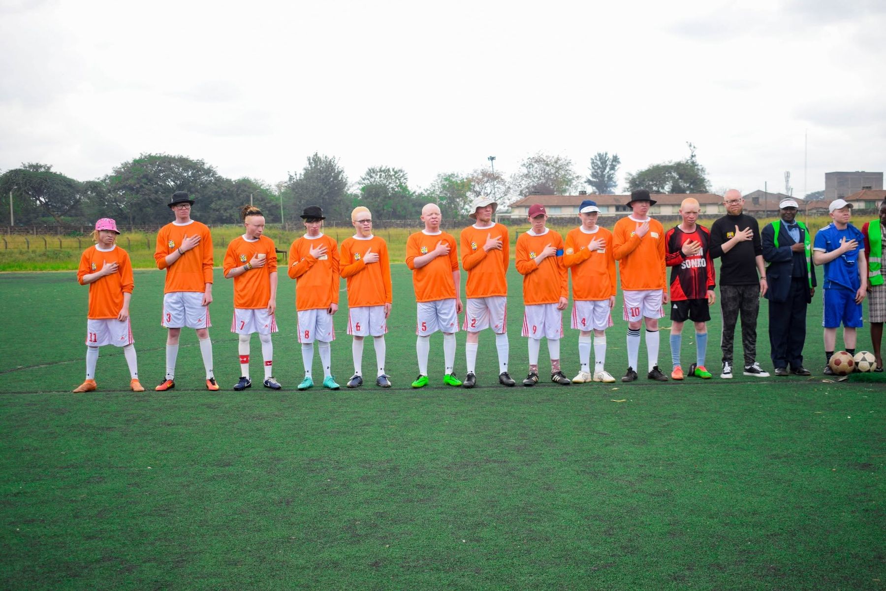 Sport run by Black Albinism, on the pitch and off it.