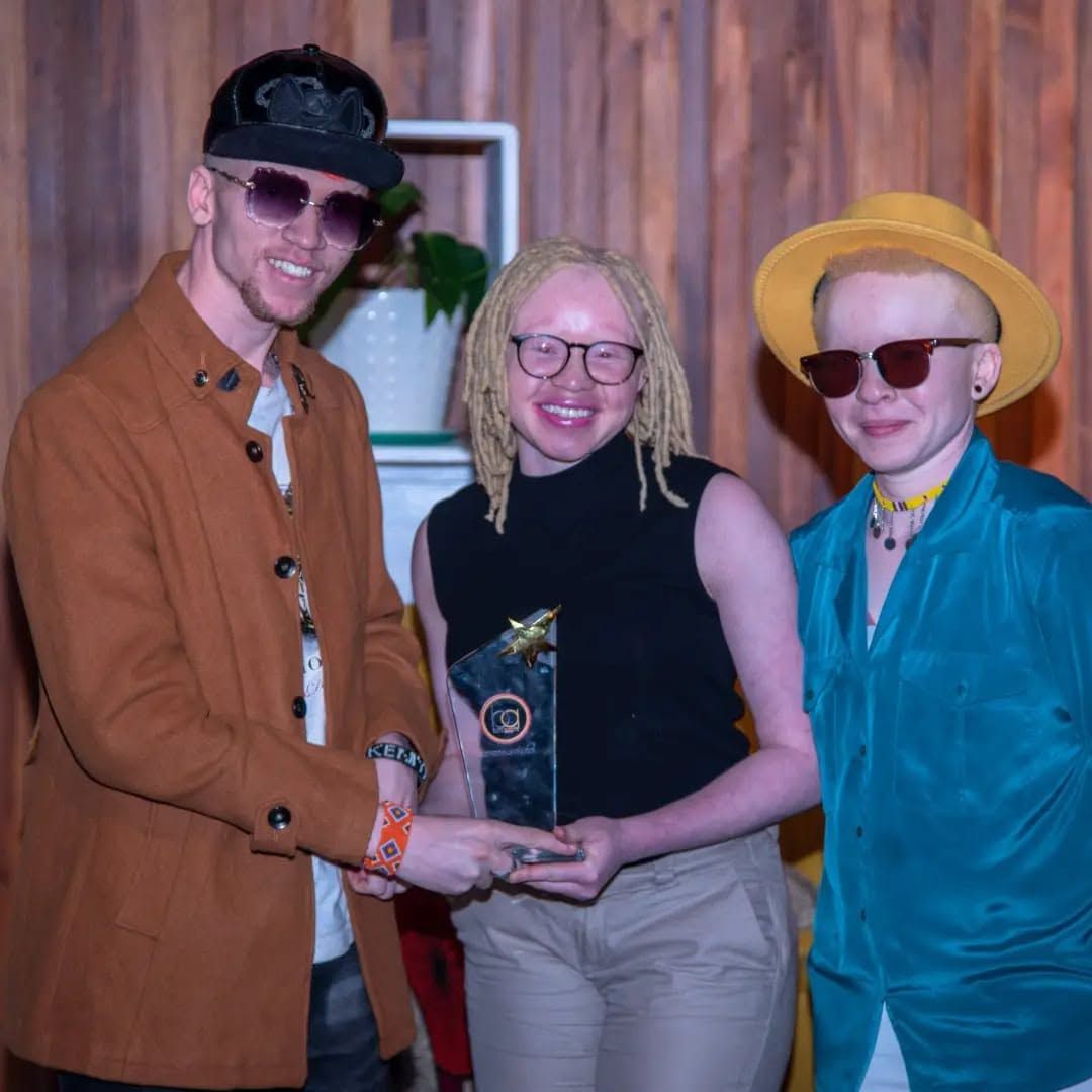 International Albinism Awareness Day 2024, marked by the Black Albinism community.
